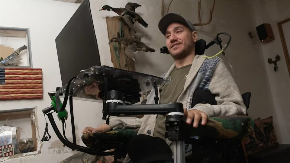 Preview: ABC: first Neuralink N1 implant patient discusses trial use